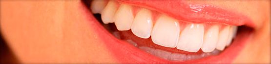 Clínica Dental Campos sonrisa de mujer